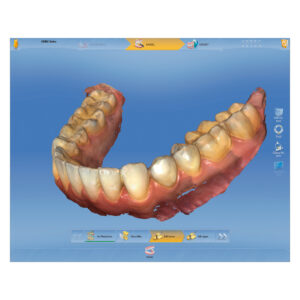 CEREC Mjukvara - CEREC SW 5.3